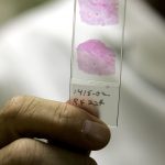 liver sample