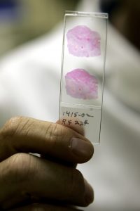 liver sample