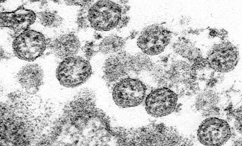 Virus outbreak kids rare syndrome