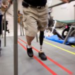 Prosthetic leg