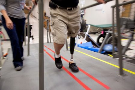 Man attacked on St. Louis street, robbed of prosthetic leg