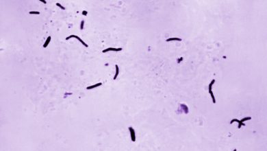Photo of CDC says tuberculosis outbreak in Kansas is alarming, but not the biggest in US history